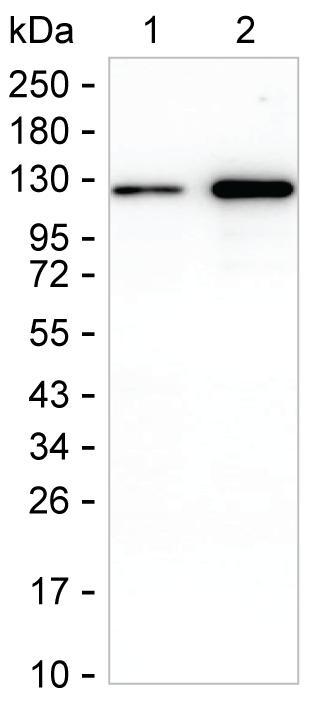IFIH1